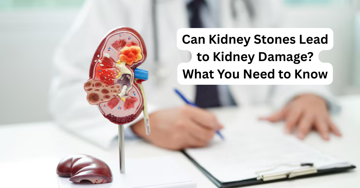 Can Kidney Stones Lead to Kidney Damage? What You Need to Know