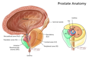 Benign prostatic hyperplasia enlarged prostate illustration