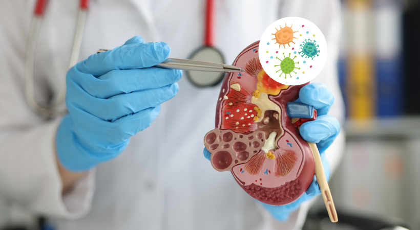 Kidney Infection