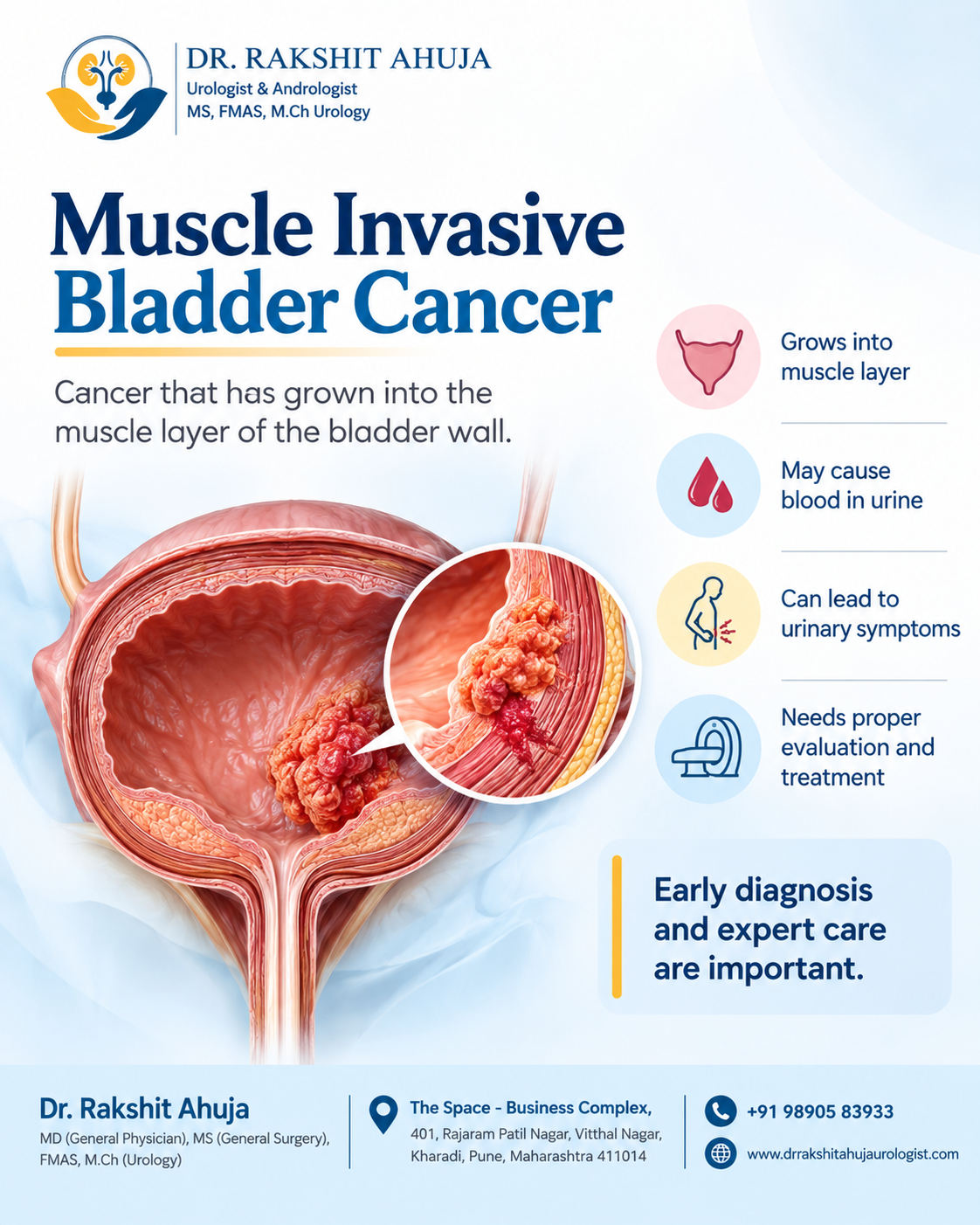 Muscle-Invasive Bladder Cancer: Symptoms, Diagnosis and Treatment Options