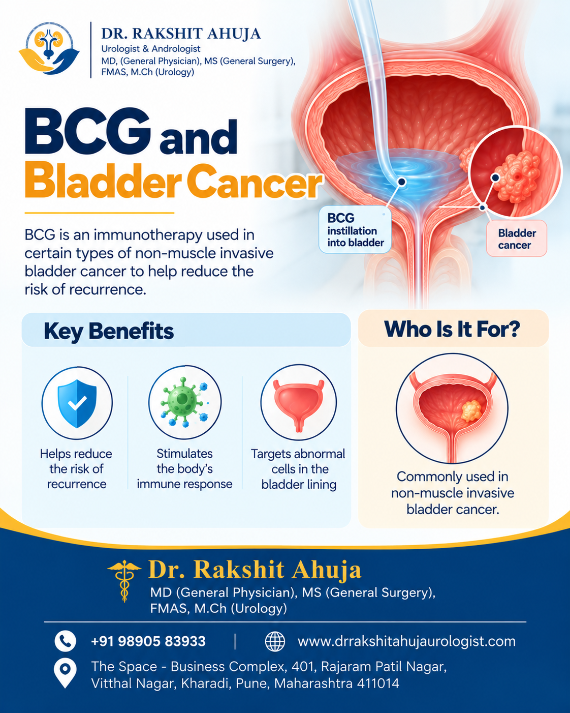 BCG and Bladder Cancer: What Patients Should Know
